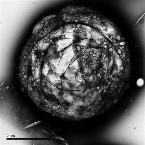 An Unprocessed Transmission Electron Microscope Image Of A Gas Core