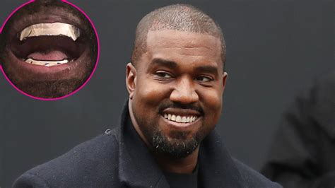 Kanye West Gets Titanium Grill That Cost 850k Us Weekly
