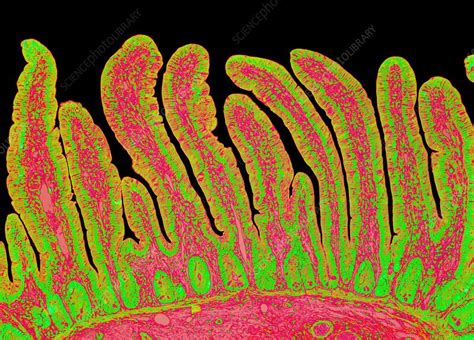 Small Intestine Light Micrograph Stock Image C0213086 Science