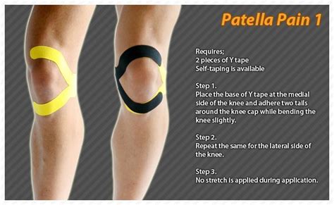 Kinesiology Taping Kinesio Taping Knee Taping