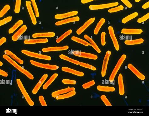 Lactobacillus Sp Coloured Scanning Electron Micrograph Sem Of The