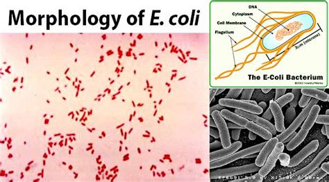 E Coli Escherichia Coli An Overview Microbe Notes