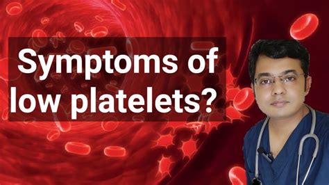 Symptoms Of Low Platelets In Hindi Platelets Doctorjoydeb Youtube