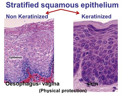 Stratified Squamous Epithelium Non Keratinized Labeled