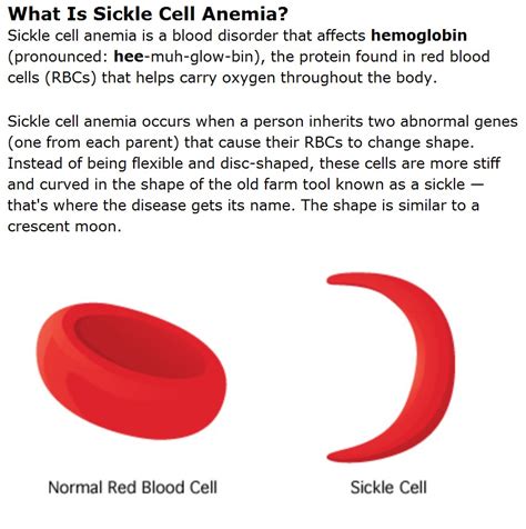 Science Reporter Sickle Cell Anemia