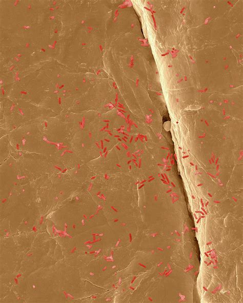 E Coli On The Human Skin Surface Photograph By Dennis Kunkel