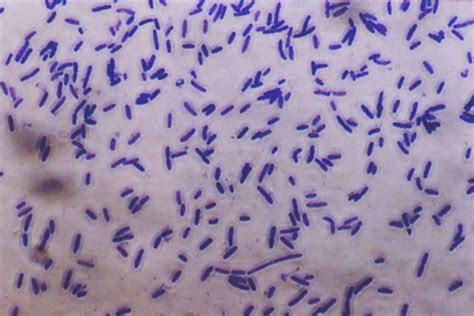 Filebacteria Photomicrograph Wikimedia Commons