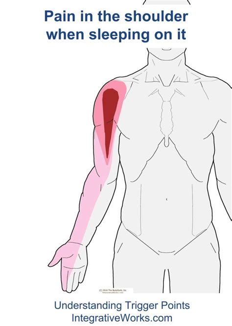 Pin On Forearm Trigger Point Pain