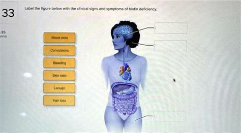 SOLVED Label The Figure Below With The Clinical Signs And Symptoms Of