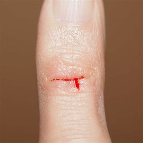 Paper Cut Finger Stock Photos Pictures And Royalty Free Images Istock