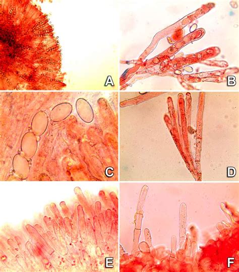 Microscopic studies of Morchella fluvialis in Congo red-ammonium. A ...