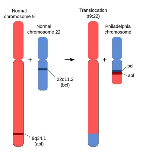Schematic Of The Philadelphia Chromosome Philadelphia Chromosome