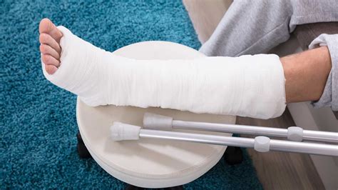 Common Causes for Broken Bones | Bone Fractures