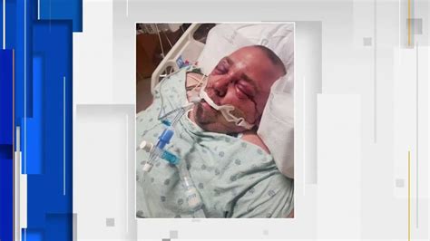 Florida Man Gets Beaten Into A Coma After Asking Neighbors To Turn Down Their Music River City