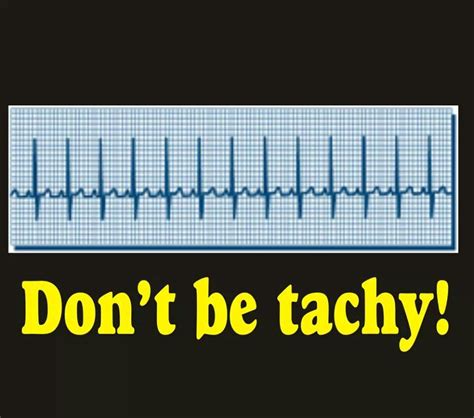 Ecg Funny Quotes Shortquotescc