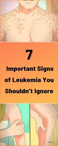 7 Important Signs Of Leukemia You Shouldnt Ignore In 2020 Health