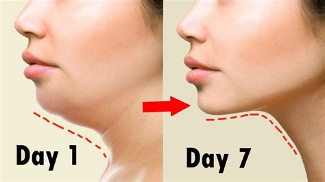 Remove Double Chin In 1 Week With Simple Steps सिर्फ 7 दिन में Double