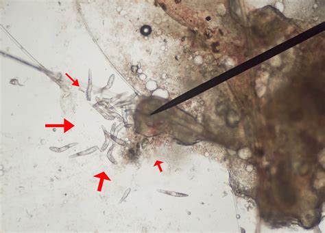 25 New Demodex Mites Under Microscope Demodectic Mange