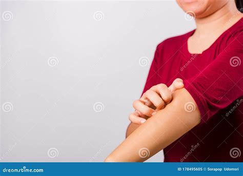 Asian Beautiful Woman Itching Her Scratching Her Itchy Arm Stock Image