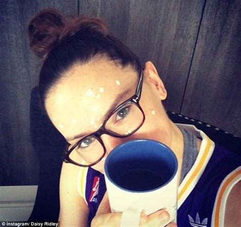 Daisy Ridley Reveals Her Ongoing Struggle With Endometriosis And Subsequent Acne