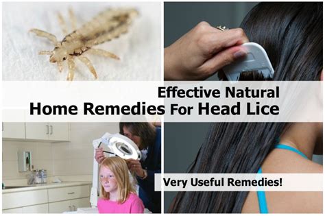 Effective Natural Home Remedies For Head Lice Head Lice Remedy