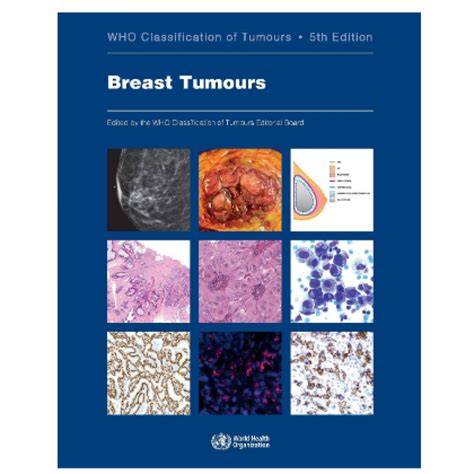 Whos Classification Of Tumours Breast Tumours 5th Edition 2019 By