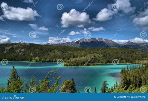 Emerald Lake Stock Image Image Of Standing View Mountains 73152467