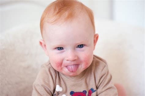 Tongue Ties Lip Ties And Frenectomies Oh My — Fountain Pediatric