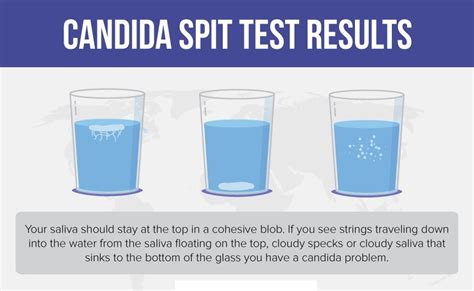 Signs Of Candida Overgrowth