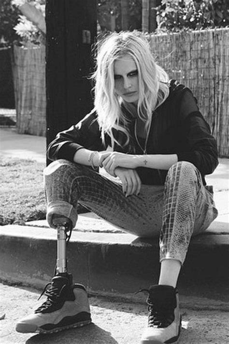 Model Who Lost Leg To Toxic Shock Syndrome Lands Huge New Campaign