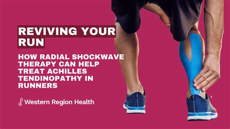 Reviving Your Run How Radial Shockwave Therapy Can Help Treat Achilles