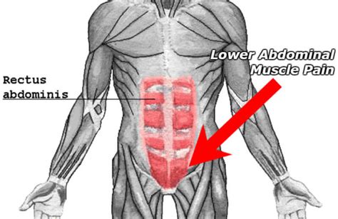 A groin strain develops when the adductor muscles along the inner thighs are partially injured or completely torn. What Does a Pulled Lower Abdominal Muscle Feel Like ...