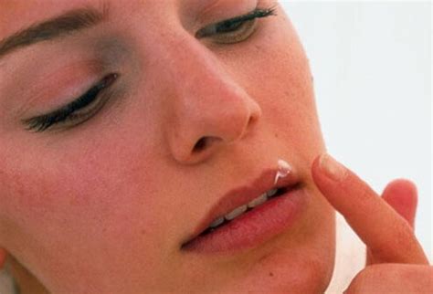 Knowing what herpes looks like across the body can help people diagnose the condition. Cold Sores Causes, Remedies, & Diagnosis