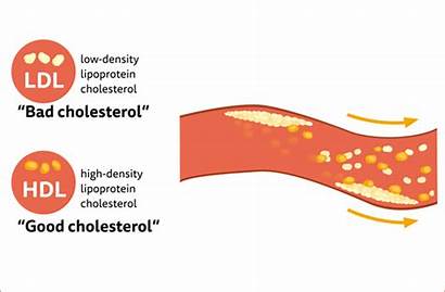 Cholesterol Bad Scientific Concept