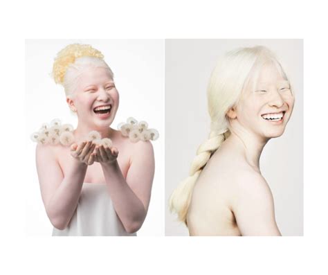Xueli Abbing Napu Tena Albino Beba Koja Je Postala Model Voguea Azra