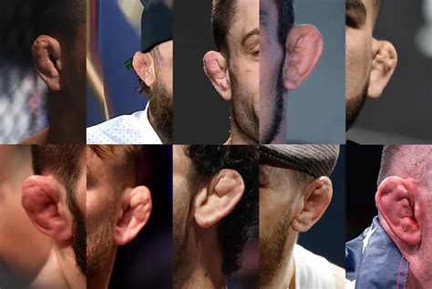 The 10 Worst Cauliflower Ear Ufc Fighters In 2021 Fightnomads Combat