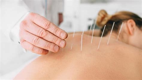 Acupuncture Maes Acupressure Massage And Acupuncture