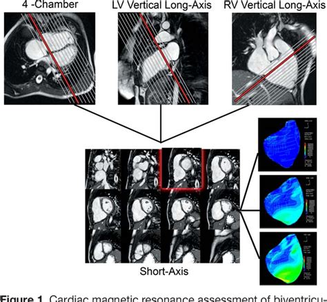 Figure 1 From Is Mri The Preferred Method For Evaluating Right