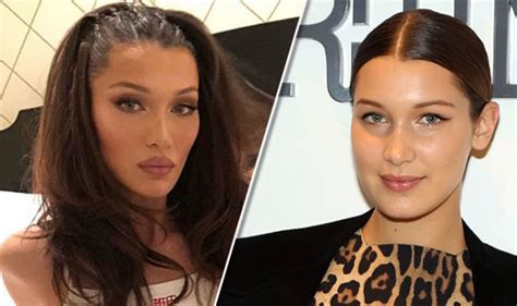 bella hadid before and after has she had surgery an expert weighs in