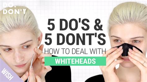 How To Get Rid Of Whiteheads On Face
