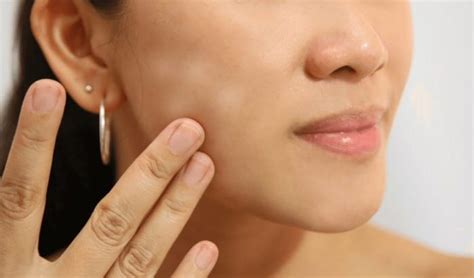 Too much vitamin d also raises the level of calcium in your blood. How to Get Rid of White Spots on Face | Active Home Remedies