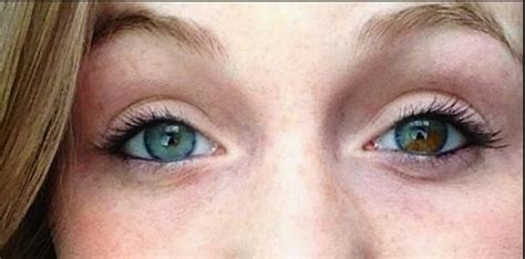 this shows rarety and how people have these eye colors my xxx hot girl