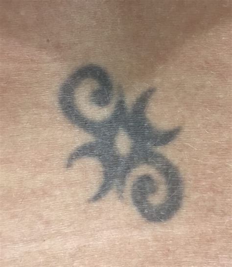 With single treatment prices starting at only $99, the cost to make your ink invisible is one less thing to worry about. Laser Tattoo Removal in Melbourne | Laser Tattoo Removal Cost