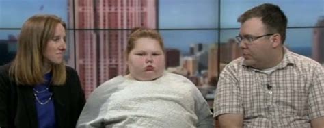 Alexis Shapiro Obese Girl 12 Fights For Gastric Bypass