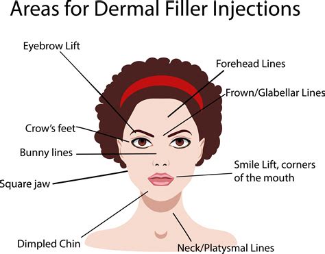 Dermal Fillers The Ultimate Guide For Uses Recovery And Results