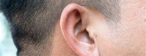 Dark Ear Wax Causes And Risks Holland And Barrett