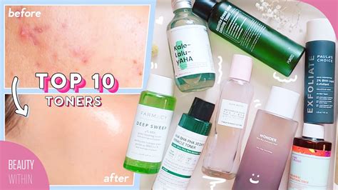 Best Toners For Acne Hyperpigmentation Large Pores Whiteheads