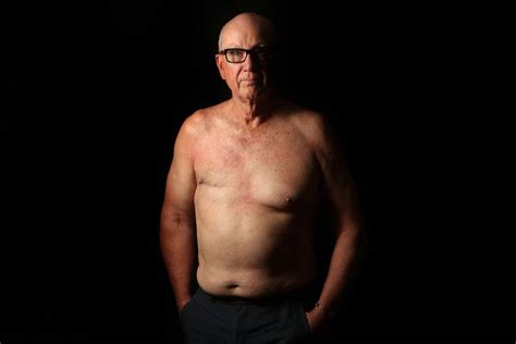 Most dna mutations related to male breast cancer occur during life rather than having been inherited from a parent before birth. Most men unaware of breast cancer danger | The Canberra ...