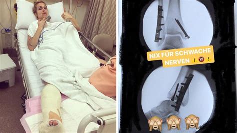 Maybe you would like to learn more about one of these? Dschungelcamp-Reporterin im Krankenhaus - der Horror-Sturz ...