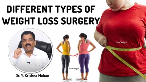 Healthandbeauty Different Types Of Weight Loss Surgery Youtube